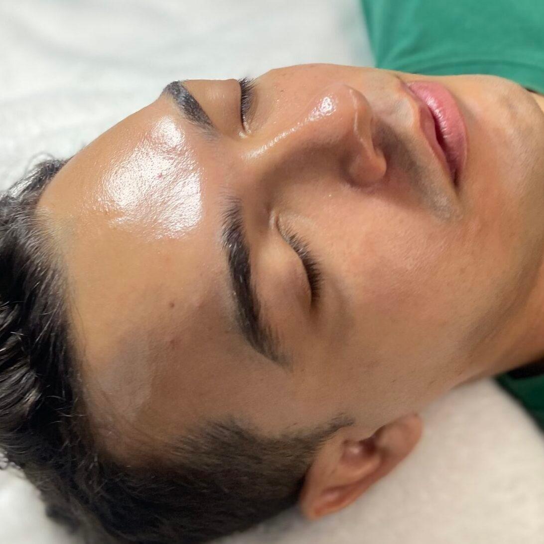 Qué hacer después de una limpieza facial
