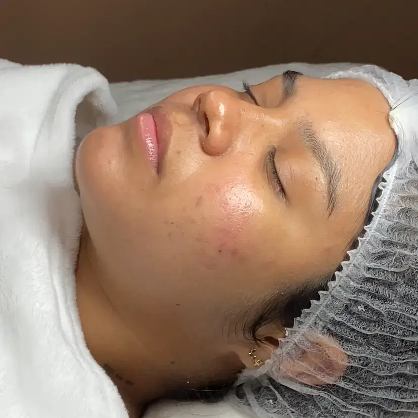 ¿Sientes la piel muy grasosa?