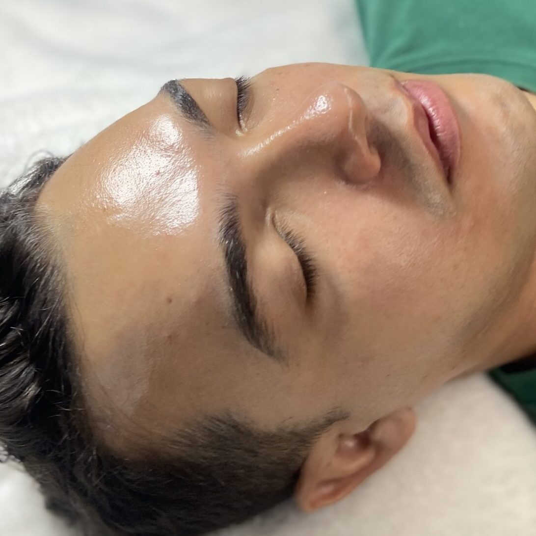 Glow Skin Extracción Limpieza Facial Peeling Porcelanizacion