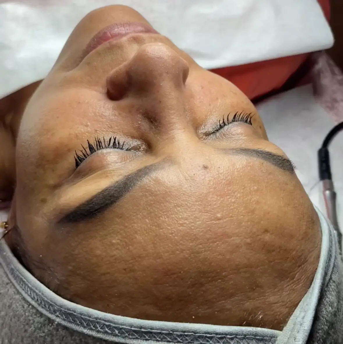 Glow Skin Extracción Limpieza Facial Peeling Porcelanizacion