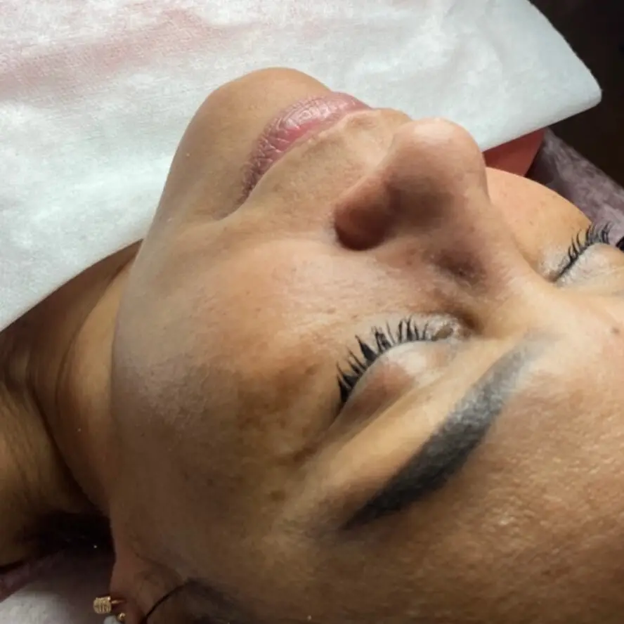 Glow Skin Extracción Limpieza Facial Peeling Porcelanizacion